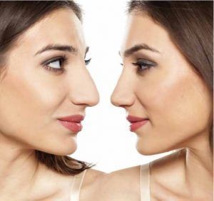 misma mujer con diferente nariz