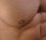 Fibromialgia, qué hay detrás