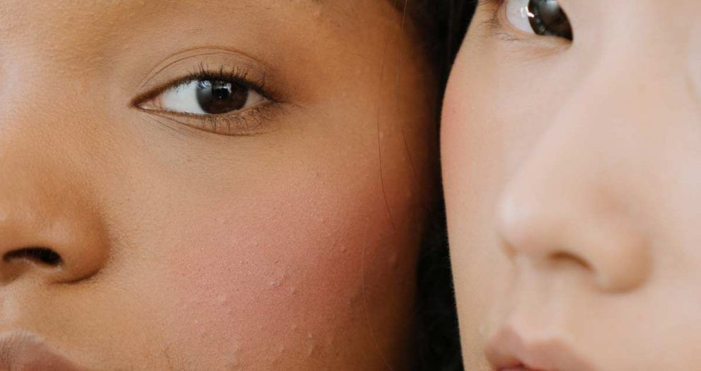 dos rostro femeninos con granitos