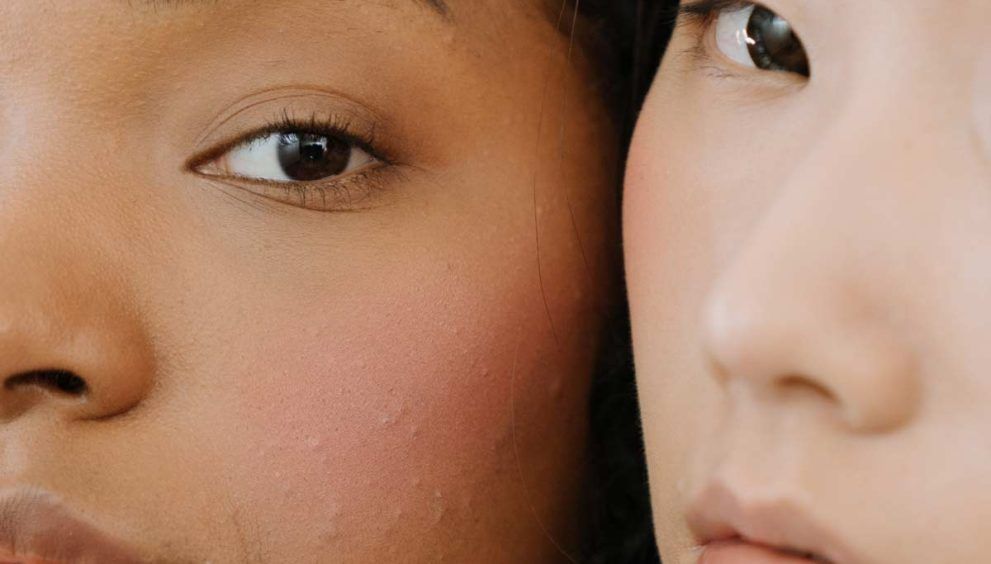 dos rostro femeninos con granitos