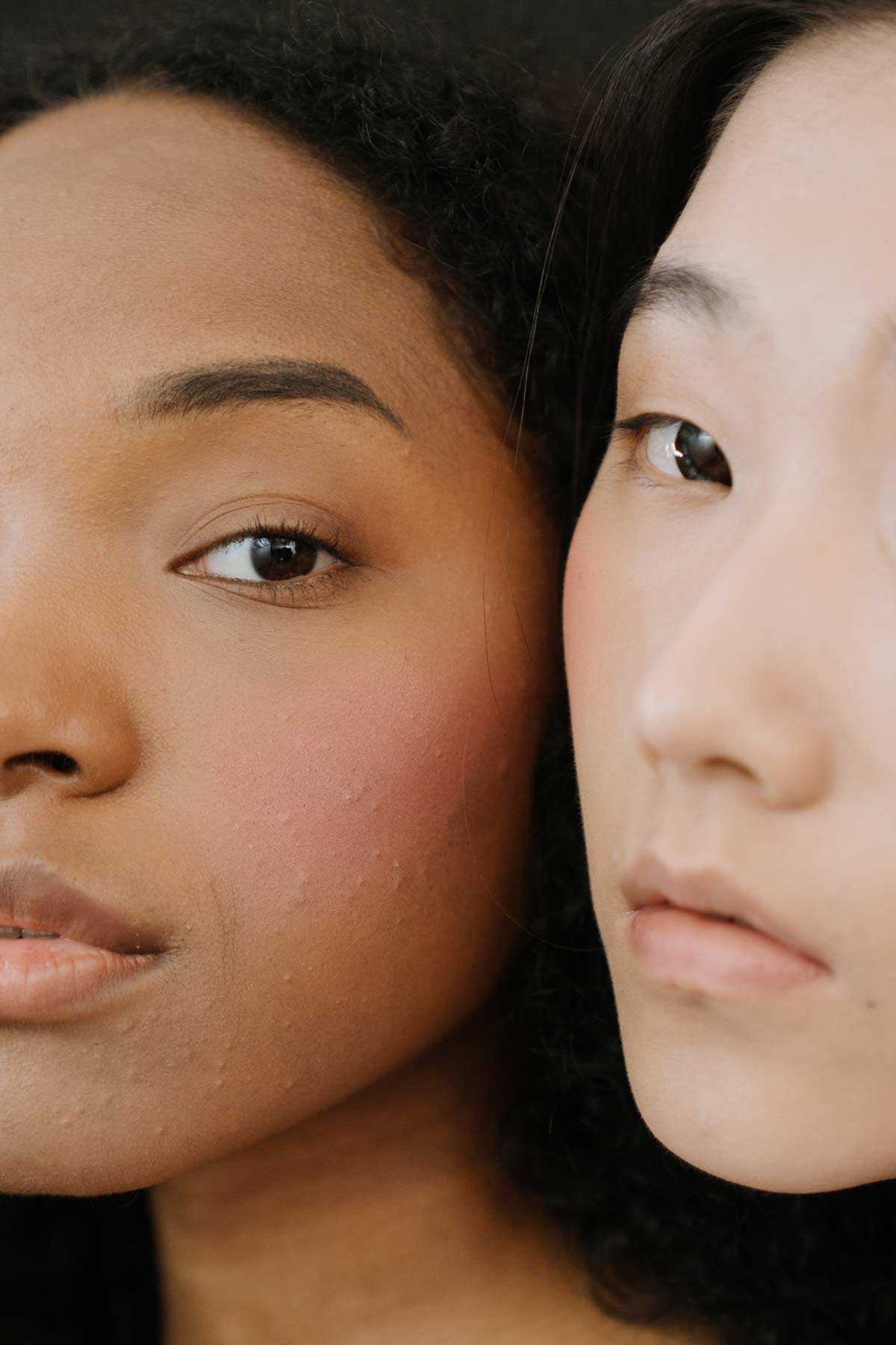 dos rostro femeninos con granitos