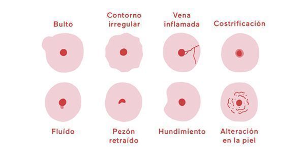 dibujos de posibles malformaciones de la mama